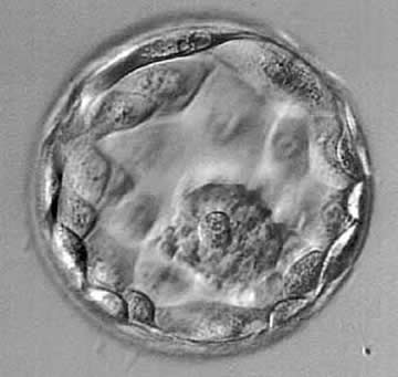 blastocystembryo.jpg