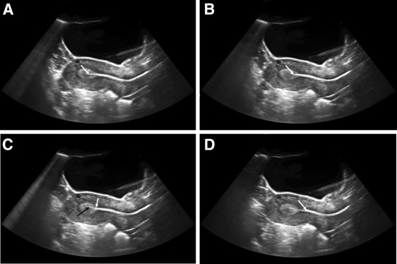 tecnica-transferencia-embrionaria.jpg