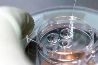 RIF es cuando varias transferencias de embriones de buena calidad no fueron exitosas. Sin embargo, vale la pena buscar un centro de FIV y un médico con la experiencia necesarias para evaluar cada caso